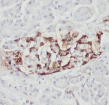 AMPH Rabbit Polyclonal Antibody