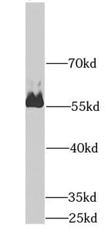 AMY2A Antibody