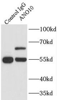 ANO10 Rabbit Polyclonal Antibody
