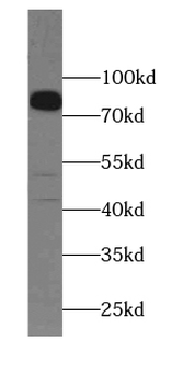ANO10 Rabbit Polyclonal Antibody