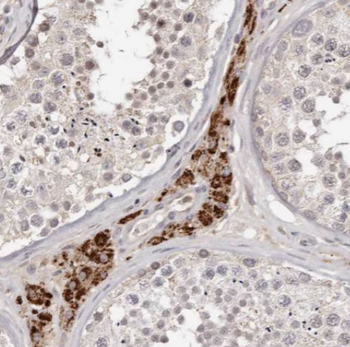 ANO10 Rabbit Polyclonal Antibody