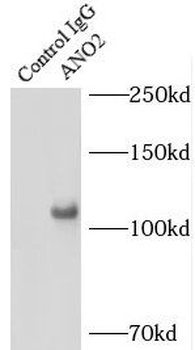 ANO2 Rabbit Polyclonal Antibody