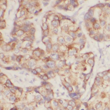 ANO2 Rabbit Polyclonal Antibody