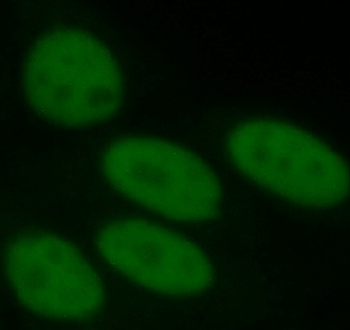 ANP32B Antibody