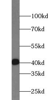 JUN Rabbit Polyclonal Antibody