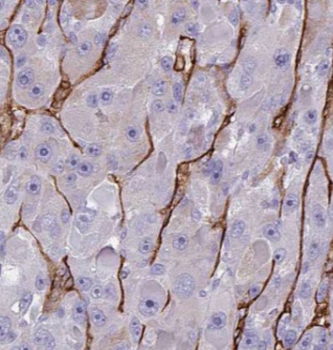 ARF6 Antibody