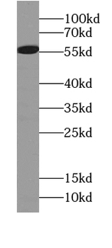 ARHGEF9 Specific Rabbit Polyclonal Antibody