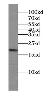 CDNF Rabbit Polyclonal Antibody