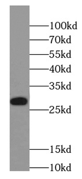 SRSF1 Rabbit Polyclonal Antibody