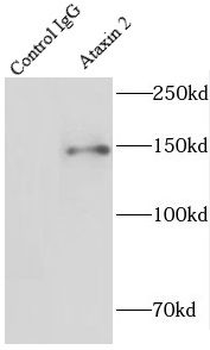 ATXN2 Antibody