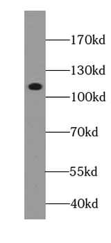 ATP1A1 Specific Rabbit Polyclonal Antibody