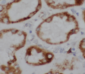 ATP1A1 Specific Rabbit Polyclonal Antibody