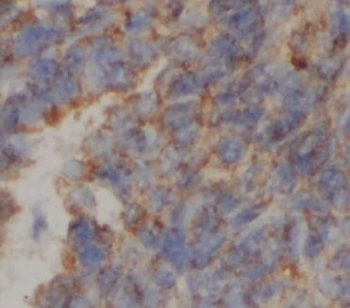 ATP5F1C Mouse Monoclonal Antibody