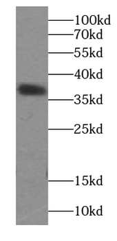 ATXN3 Antibody