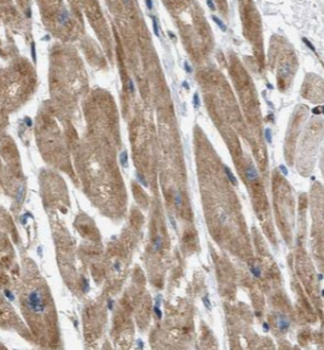 ADGRB2 Specific Rabbit Polyclonal Antibody