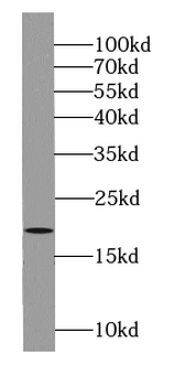 ARL6 Rabbit Polyclonal Antibody