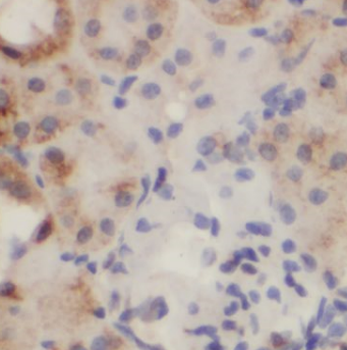 ARL6 Rabbit Polyclonal Antibody
