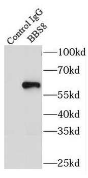TTC8 Antibody