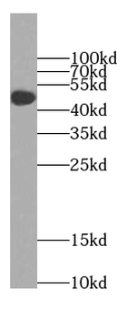 TTC8 Antibody