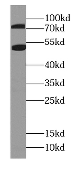 BEST3 Rabbit Polyclonal Antibody