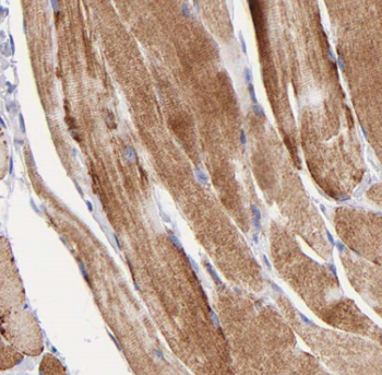 BEST3 Rabbit Polyclonal Antibody