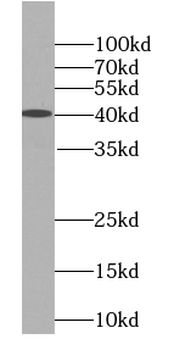 UBL7 Rabbit Polyclonal Antibody