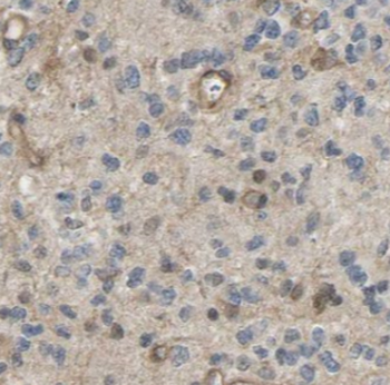 UBL7 Rabbit Polyclonal Antibody