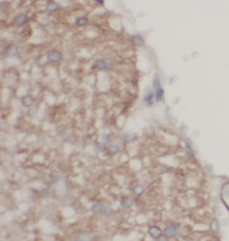 BCAN Rabbit Polyclonal Antibody