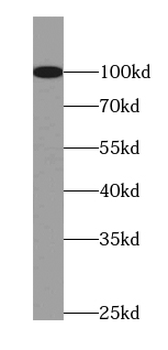 MCPH1 Antibody