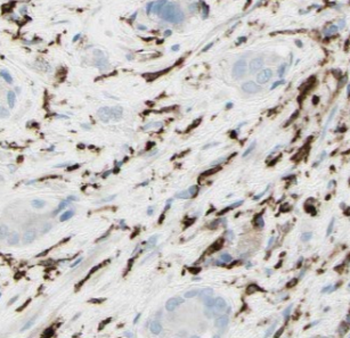MCPH1 Antibody
