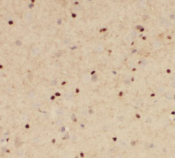 POU3F2 Specific Rabbit Polyclonal Antibody