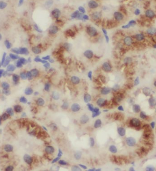 UQCC3 Rabbit Polyclonal Antibody