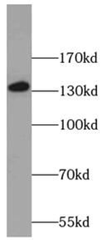 NRDE2 Rabbit Polyclonal Antibody
