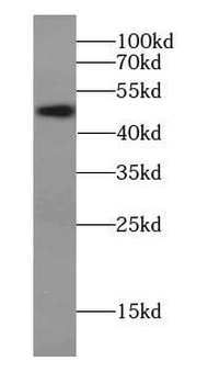 VCPKMT Antibody
