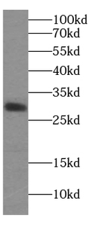 TPGS1 Rabbit Polyclonal Antibody