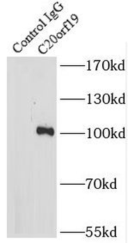 KIZ Rabbit Polyclonal Antibody