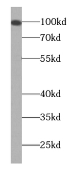 KIZ Rabbit Polyclonal Antibody