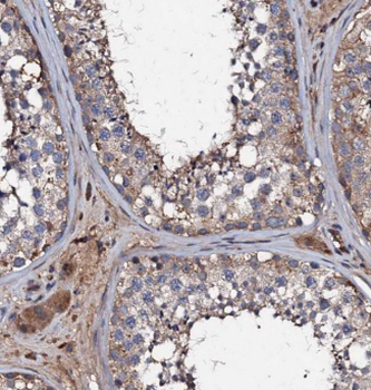 KIZ Rabbit Polyclonal Antibody