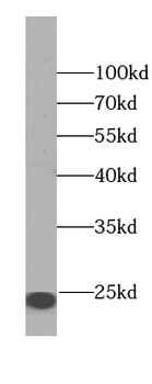 CAPS Rabbit Polyclonal Antibody