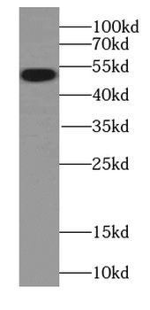 CAPS2 Rabbit Polyclonal Antibody