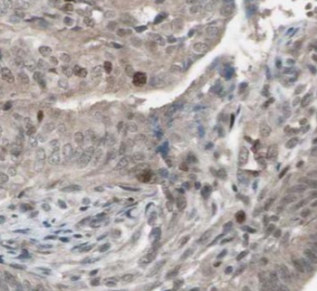 CAPS2 Rabbit Polyclonal Antibody