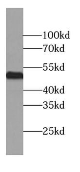 CAMK2A Specific Rabbit Polyclonal Antibody