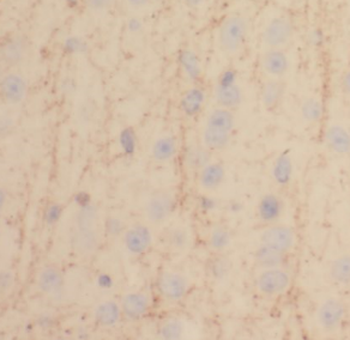 CAMK2A Specific Rabbit Polyclonal Antibody