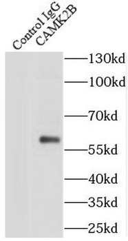 CAMK2B Rabbit Polyclonal Antibody
