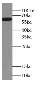 CAMK2B Rabbit Polyclonal Antibody