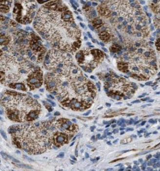 CAMK2B Rabbit Polyclonal Antibody