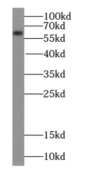 CAMK2B Rabbit Polyclonal Antibody