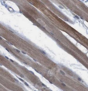 CAMK2B Rabbit Polyclonal Antibody