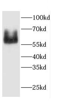 CAMK2G Rabbit Polyclonal Antibody