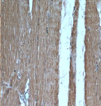 CAMK2G Rabbit Polyclonal Antibody